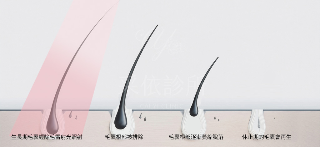 毛髮生長週期